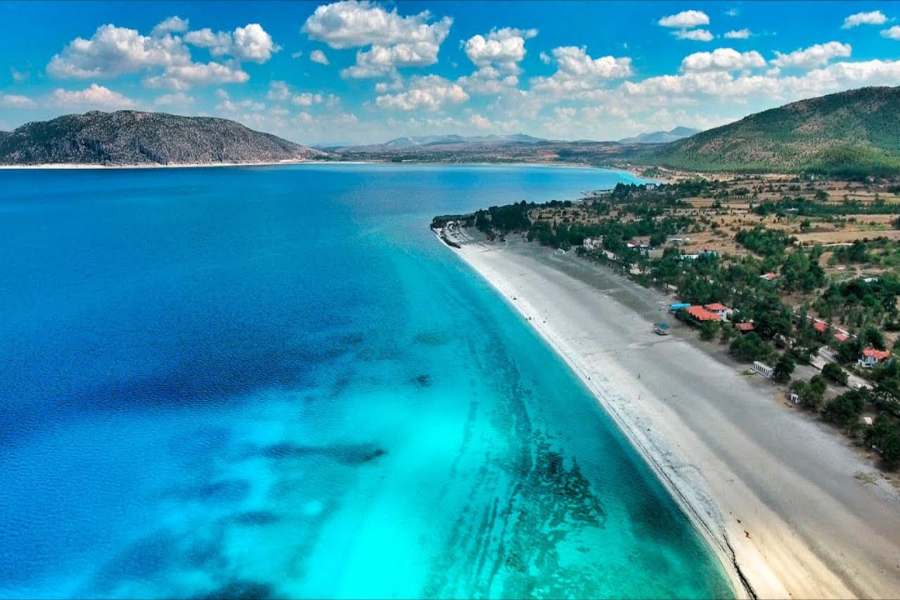 Burdur Ortodontik Tedavi Diş Telleri Ne Kadar Sürede Etki Eder