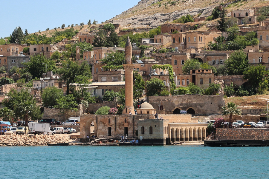 Şanlıurfa İmplant Yaptırmadan Önce Bilmeniz Gerekenler